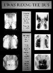 X-Ray Project 1
